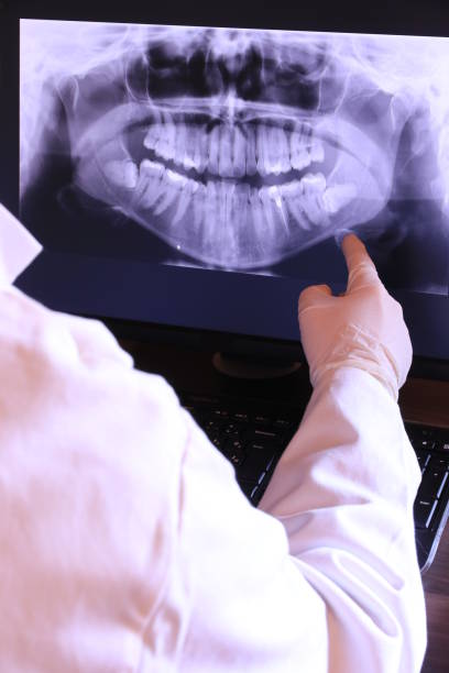 Emergency Dental Filling Replacement in MS